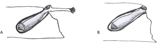 figure image